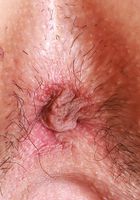Amber Summer Pussy Gaping, Amber Summer (amb070) ATK Petites: Amber Summer (Amber Summer Pussy Gaping)