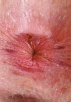 ATK Natural & Hairy: Apricot Pitts (Apricot Pitts Flaunts her Fur and Spreads)