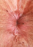 Ashyln Peaks Spreads Outdoors, Ashlyn Peaks (ash078) ATK Exotics: Ashlyn Peaks (Ashyln Peaks Spreads Outdoors)