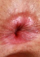 Asia Rivera Gaping outside a Bikini, Asia Rivera (asi010) ATK Petites: Asia Rivera (Asia Rivera Gaping outside a Bikini)