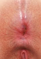 Bess Breast Outdoor Nudity, Bess Breast (bes004) ATK Natural & Hairy: Bess Breast (Bess Breast Outdoor Nudity)