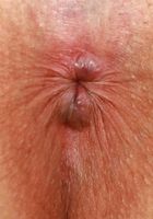 Brynn Michaels Bikini Spreads, Brynn Michaels (bry008) ATK Natural & Hairy: Brynn Michaels (Brynn Michaels Bikini Spreads)