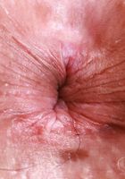 ATK Galleria: Dez Hansen (Dez Hansen strips indoors)