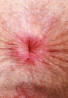 ATK Natural & Hairy: Fiona Peaches (Fiona Peaches shows it off)