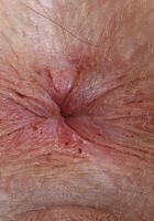 Jessae Rosae Tiny Pink Panties and Pussy, Jessae Rosae (jes765) ATK Galleria: Jessae Rosae (Jessae Rosae Tiny Pink Panties and Pussy)
