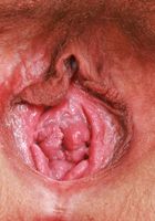 ATK Natural & Hairy: Remi Ferdinand (Remi Ferdinand Big Ass Big Bush Spreading)