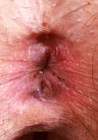 ATK Petites: Riley Rose (Riley Rose pinches nipples and tugs pubes)