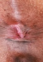 ATK Exotics: Rue (Rue takes the stage)