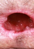 ATK Natural & Hairy: Sia Wood (Sia Wood has an inviting hole or two)